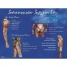 Life-form Intramuscular Injection Sites Poster