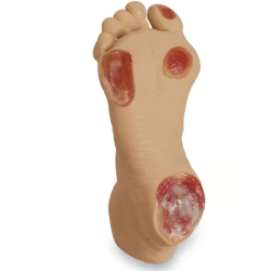 Life-form Elderly Pressure Ulcer Foot