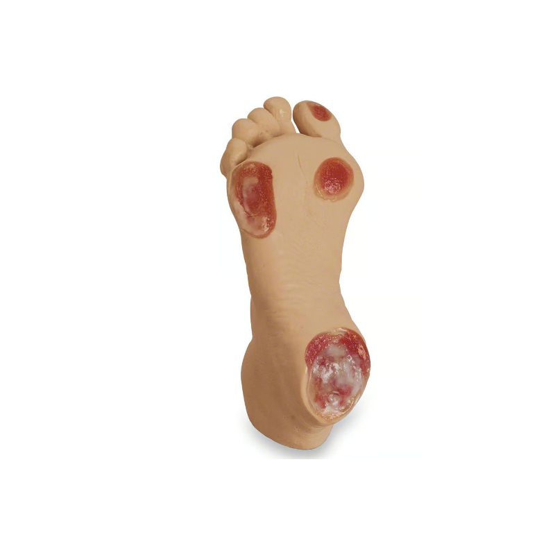 Life-form Elderly Pressure Ulcer Foot