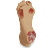 Life-form Elderly Pressure Ulcer Foot