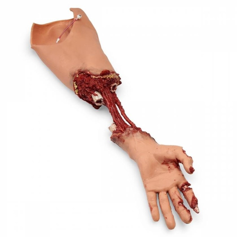 Simulaids Xtreme Trauma Bleeding Arm Moulage for SMART STAT Patient Simulator