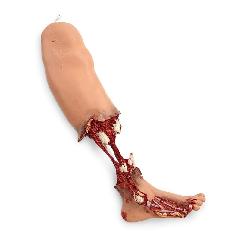 Simulaids Xtreme Trauma Bleeding Leg Moulage for SMART STAT Patient Simulator